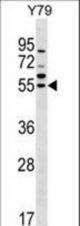 FDXR Antibody western blot of Y79 cell line lysates (35 ug/lane). The FDXR antibody detected the FDXR protein (arrow).