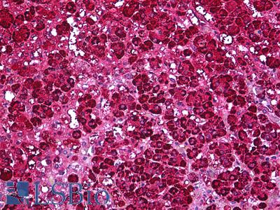 Anti-FDXR antibody IHC of human adrenal. Immunohistochemistry of formalin-fixed, paraffin-embedded tissue after heat-induced antigen retrieval. Antibody LS-B5921 dilution 1:200.