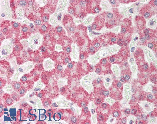 Human Liver: Formalin-Fixed, Paraffin-Embedded (FFPE)