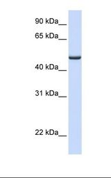 Human liver lysate. Antibody concentration: 1.0 ug/ml. Gel concentration: 12%.