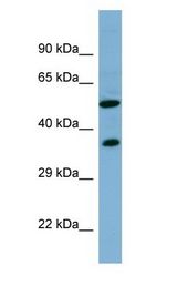 FDXR antibody Western Blot of Human Small Intestine.