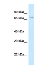 APBB2 antibody LS-C145341 Western blot of Rat Liver lysate. Antibody concentration 1 ug/ml.