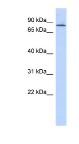 APBB2 antibody LS-C102678 Western blot of Fetal Lung lysate.