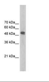 Jurkat Cell Lysate