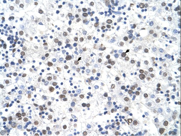 FECH antibody LS-C40349 was used in IHC to stain formalin-fixed, paraffin-embedded human liver.