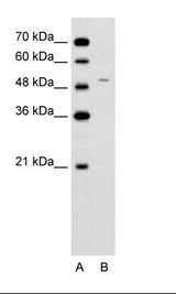 A: Marker, B: Jurkat Cell Lysate