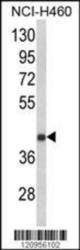 Western blot of FECH Antibody (N-term) in NCI-H460 cell line lysates (35 ug/lane). FECH (arrow) was detected using the purified Pab.