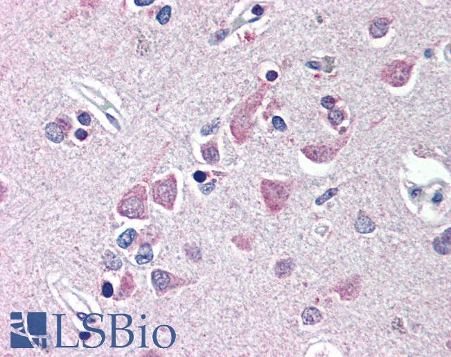 Anti-FEM1B antibody IHC of human brain, cortex. Immunohistochemistry of formalin-fixed, paraffin-embedded tissue after heat-induced antigen retrieval. Antibody LS-B568 concentration 10 ug/ml.