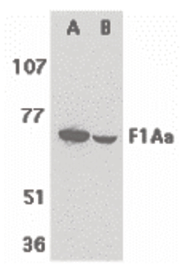 Western blot of F1A alpha in mouse (A) and rat (B) liver tissue lysates with F1A alpha antibody at 1 ug/ml.