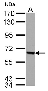 Sample (30 ug of whole cell lysate) A: HepG2 7.5% SDS PAGE FEM1C antibody diluted at 1:5000
