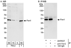 Detection of human Fen1 in whole cell lysates of HeLa and 293T cells (5-50 ug/lane) by Western blotting with Rabbit anti-Human Fen1 (LS-C43020). Immunoprecipitation was with LS-C43020 (3 ug/mg lysate) or another anti-Fen1 polyclonal antibody, subsequent detection of immunoprecipitated Fen1 by Western blotting used LS-C43020.