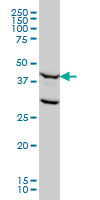 FEN1 monoclonal antibody (M01A), clone 1E2 Western Blot analysis of FEN1 expression in HeLa NE.