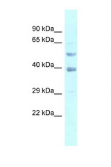 FEN1 antibody LS-C145868 Western blot of 293T Cell lysate. Antibody concentration 1 ug/ml.