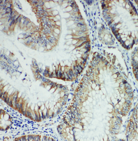 FER antibody. IHC(P): Rat Intestine Tissue.