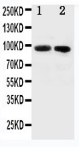 WB of FER antibody. All lanes: Anti-FER at 0.5ug/ml. Lane 1: Rat Testis Tissue Lysate at 40ug. Lane 2: Rat Ovary Tissue Lysate at 40ug. Predicted bind size: 95KD. Observed bind size: 95KD.