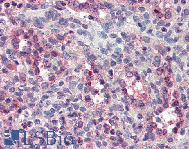 Anti-FER antibody IHC of human spleen. Immunohistochemistry of formalin-fixed, paraffin-embedded tissue after heat-induced antigen retrieval. Antibody LS-B3467 dilution 1:200.