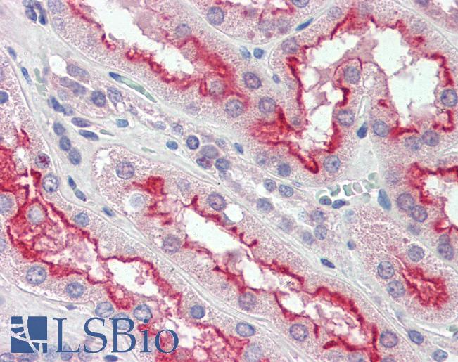 Anti-FER antibody IHC of human kidney. Immunohistochemistry of formalin-fixed, paraffin-embedded tissue after heat-induced antigen retrieval. Antibody LS-B3467 dilution 1:200.
