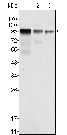 Western blot using FER mouse monoclonal antibody against NIH/3T3 (1), A549 (2) and SK-MEL-5 (3) cell lysate.