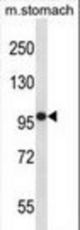 Mouse Fer Antibody western blot of mouse stomach tissue lysates (35 ug/lane). The Fer antibody detected the Fer protein (arrow).