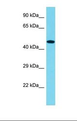 Western blot of Human Jurkat. FERMT1 antibody dilution 1.0 ug/ml.