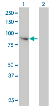 Western Blot analysis of FES expression in transfected 293T cell line by FES monoclonal antibody (M01), clone 3A3-1E5.Lane 1: FES transfected lysate(93 KDa).Lane 2: Non-transfected lysate.