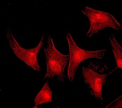 Immunofluorescent staining of HeLa cells using anti-FES antibody.