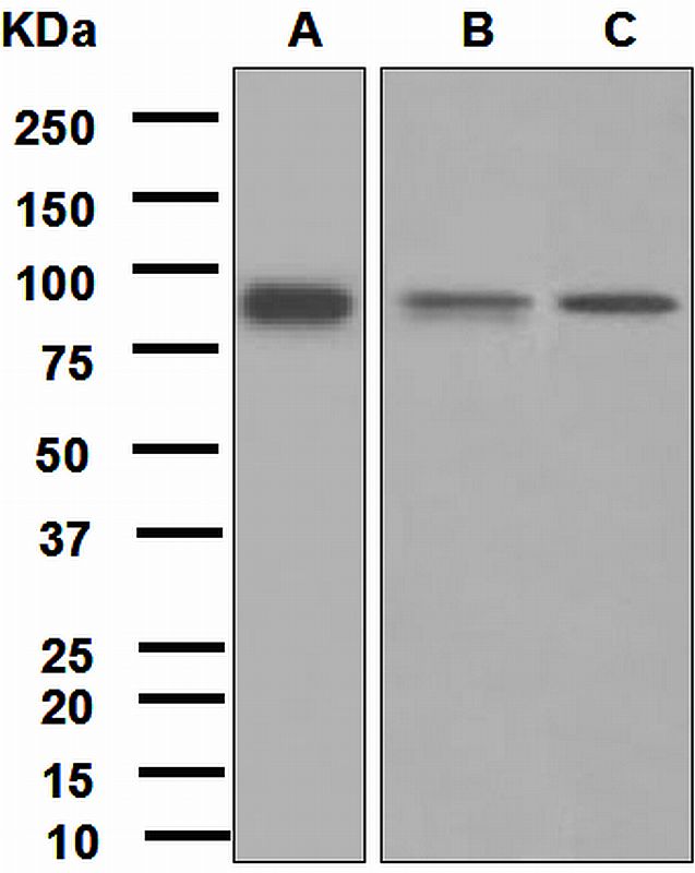 Western blot analysis on (A) TF-1, (B) U937, and (C) human spleen lysates using anti-FES antibody.