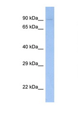 FES antibody LS-C146348 Western blot of Fetal Muscle lysate. Antibody concentration 1 ug/ml.
