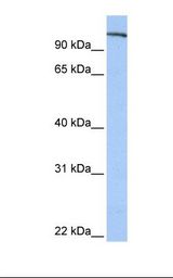 Placenta lysate. Antibody concentration: 1.0 ug/ml. Gel concentration: 12%.