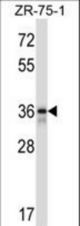 FETUB Antibody western blot of ZR-75-1 cell line lysates (35 ug/lane). The FETUB antibody detected the FETUB protein (arrow).
