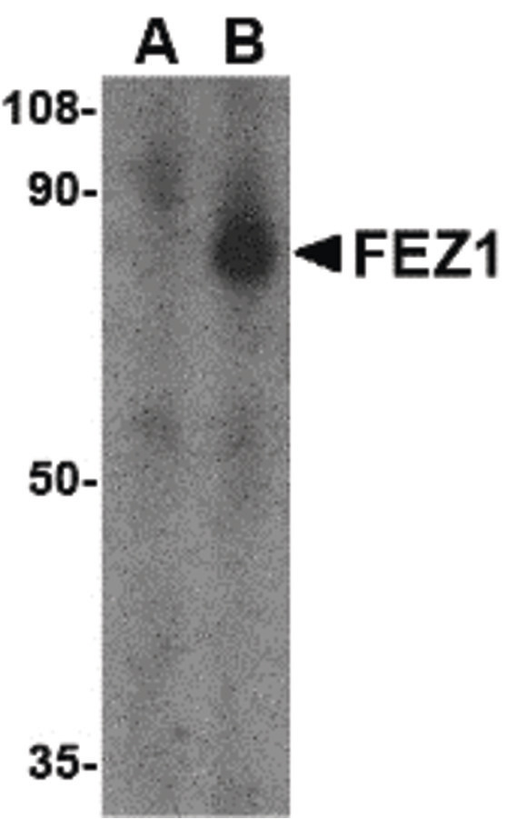 Western blot of FEZ1 in SK-N-SH cell lysate with FEZ1 antibody at 1 ug/ml in the (A) presence and (B) absence of blocking peptide.