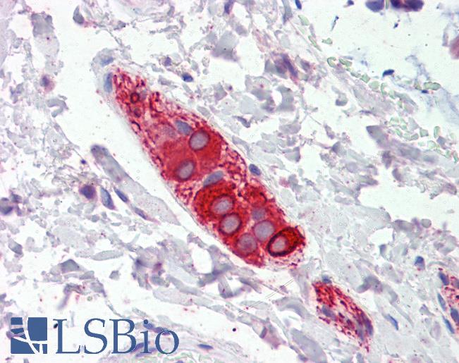 Anti-FEZ1 antibody IHC of human colon, submucosal plexus. Immunohistochemistry of formalin-fixed, paraffin-embedded tissue after heat-induced antigen retrieval. Antibody LS-B3602 concentration 5 ug/ml.