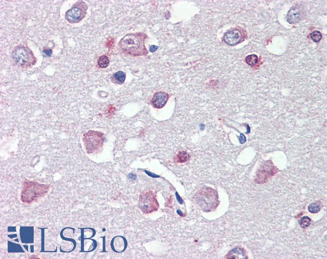 Anti-FEZ1 antibody IHC of human brain, cortex. Immunohistochemistry of formalin-fixed, paraffin-embedded tissue after heat-induced antigen retrieval. Antibody LS-B3602 concentration 5 ug/ml.