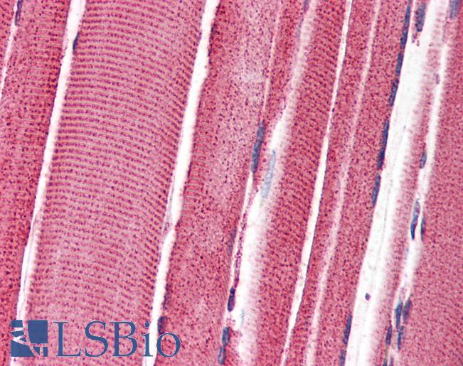 Anti-FEZ2 antibody IHC of human skeletal muscle. Immunohistochemistry of formalin-fixed, paraffin-embedded tissue after heat-induced antigen retrieval. Antibody LS-B2703 concentration 3 ug/ml.