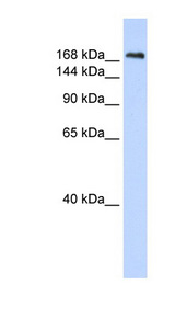 CNTNAP1 / CASPR antibody LS-C102173 Western blot of Fetal Lung lysate.