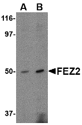 Western blot of FEZ2 in mouse brain tissue lysate with FEZ2 antibody at (A) 0.5, and (B) 1 ug/ml.
