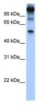 Western analysis of Hela cell lysate.