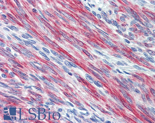 Anti-GPR40 antibody IHC of human uterus. Immunohistochemistry of formalin-fixed, paraffin-embedded tissue after heat-induced antigen retrieval. Antibody LS-B4078 concentration 10 ug/ml.