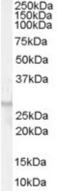 Antibody (0.01 ug/ml) staining of Human Breast lysate (35 ug protein in RIPA buffer). Primary incubation was 1 hour. Detected by chemiluminescence.