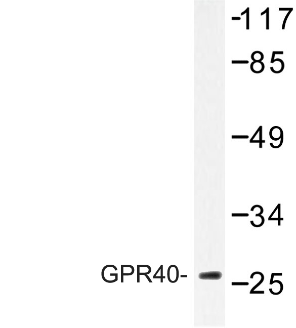 Western blot of GPR40 (W224) pAb in extracts from COS-7 cells treated with forskolin 40nM 30'.