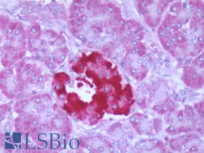 Human Pancreas: Formalin-Fixed, Paraffin-Embedded (FFPE)