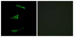 Immunofluorescence of LOVO cells, using FFAR1 Antibody. The picture on the right is treated with the synthesized peptide.