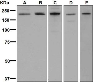 Western blot analysis on (A) C6, (B) Neuro-2a, (C) U87-MG, (D) fetal brain, and (E) fetal lung lysates using anti-CNTNAP1 / CASPR antibody.