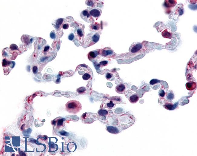Anti-FFAR2 / GPR43 antibody IHC of human lung. Immunohistochemistry of formalin-fixed, paraffin-embedded tissue after heat-induced antigen retrieval.
