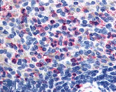 Anti-GPR43 antibody LS-A6599 IHC of human spleen, neutrophils. Immunohistochemistry of formalin-fixed, paraffin-embedded tissue after heat-induced antigen retrieval.