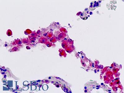 Human, Lung, Macrophages: Formalin-Fixed Paraffin-Embedded (FFPE)