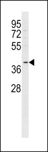 FFAR2 Antibody western blot of MDA-MB453 cell line lysates (35 ug/lane). The FFAR2 antibody detected the FFAR2 protein (arrow).