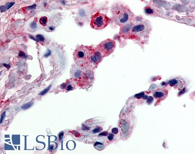 Anti-GPR43 antibody LS-A6598 IHC of human lung, alveolar macrophages. Immunohistochemistry of formalin-fixed, paraffin-embedded tissue after heat-induced antigen retrieval.