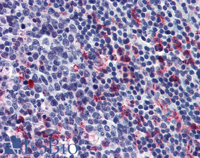 Anti-GPR43 antibody IHC of human tonsil. Immunohistochemistry of formalin-fixed, paraffin-embedded tissue after heat-induced antigen retrieval. Antibody LS-B5986 concentration 5 ug/ml.