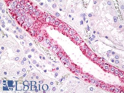 Human Kidney: Formalin-Fixed, Paraffin-Embedded (FFPE)